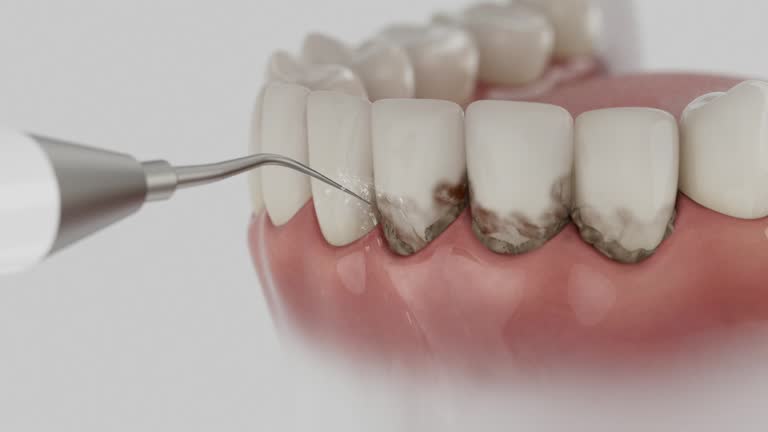 Reliable Tooth Extraction contractor in Norman, OK by Smile Center Dentistry